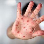 WEB.00_00_00_28.Imagen fija005